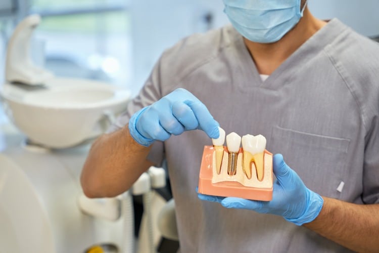 Manutenção de Implante Dentário