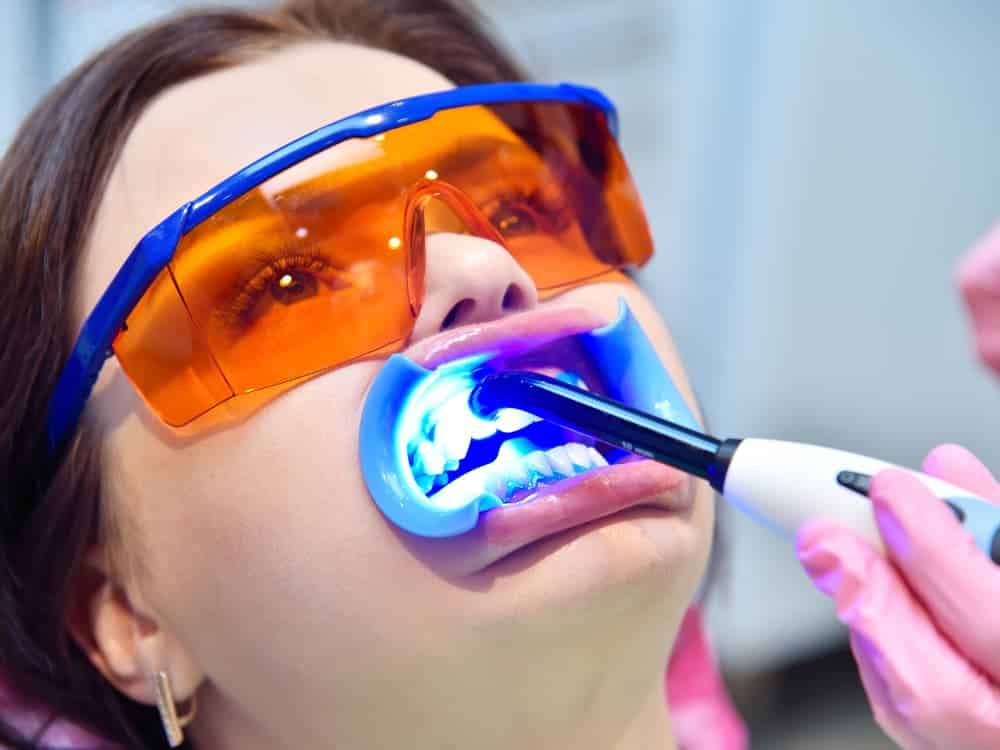 Benefícios do Clareamento Dental