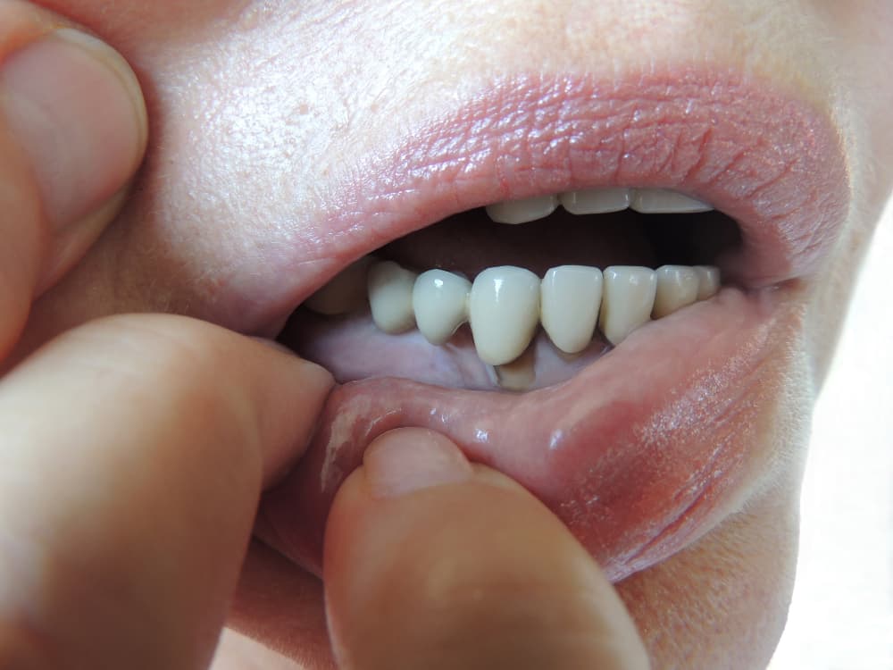 O que é periodontia na odontologia?