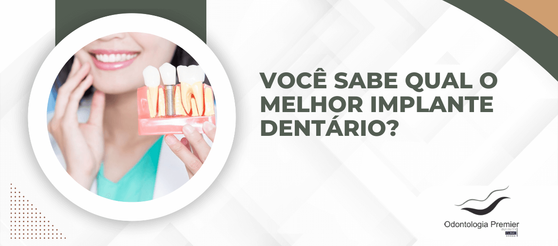 Dentista segurando modelo de arcada com implantes dentários ao lado da frase: Você sabe qual o melhor implante dentário? – Odontologia Premier.