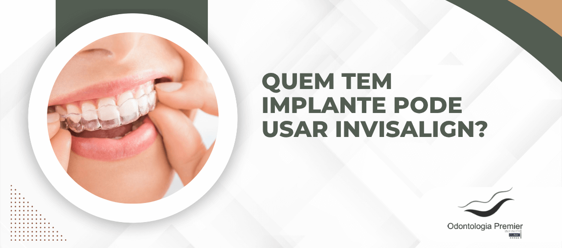 Arte gráfica de fundo azul com o título: "Quem tem implante pode usar Invisalign?". A imagem exibe um ícone estilizado de dentes com um implante para ilustrar a questão.