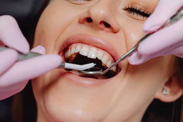 Paciente sorrindo enquanto o profissional realiza avaliação intraoral com instrumentos odontológicos durante atendimento relacionado ao Implante Zigomático.