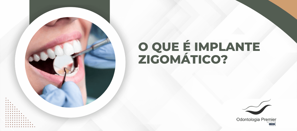 Imagem ilustrativa com paciente em avaliação odontológica e título explicativo destacando O que é implante zigomático.