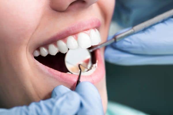 Close de avaliação odontológica com instrumentos examinando os dentes do paciente durante acompanhamento relacionado ao Implante Zigomático.