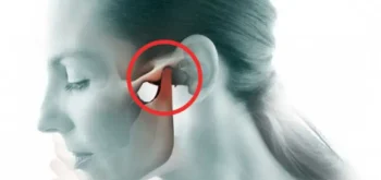Cirurgia ATM em Blumenau - Odontologia Premier
