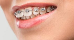 odontologiapremier-Implantodontia-BlumenauSC